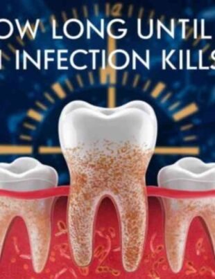 How Long Until A tooth Infection Kills You